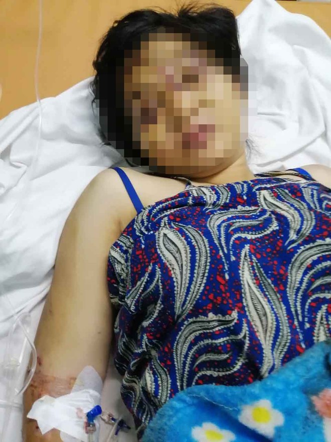 Khởi tố, bắt tạm giam 1 trong 2 kẻ chủ mưu vụ tra tấn cô gái mang thai 6 tháng khiến thai nhi tử vong ở Sài Gòn - Ảnh 2.
