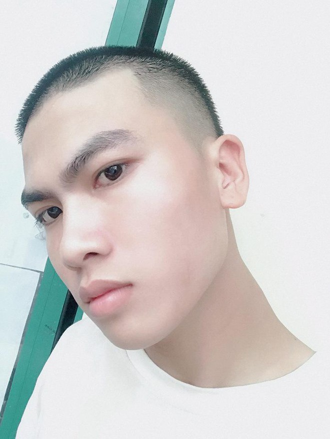 Tai nạn của thanh ni&ecirc;n chứng minh một trong những sai lầm lớn của đời người ch&iacute;nh l&agrave; cắt t&oacute;c theo thần tượng  - Ảnh 2.