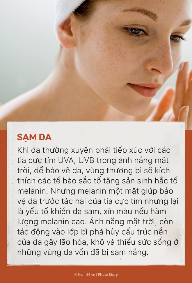 Những t&aacute;c hại của &aacute;nh nắng m&agrave; bạn cần đề ph&ograve;ng cho những ng&agrave;y h&egrave; đang tới - Ảnh 1.