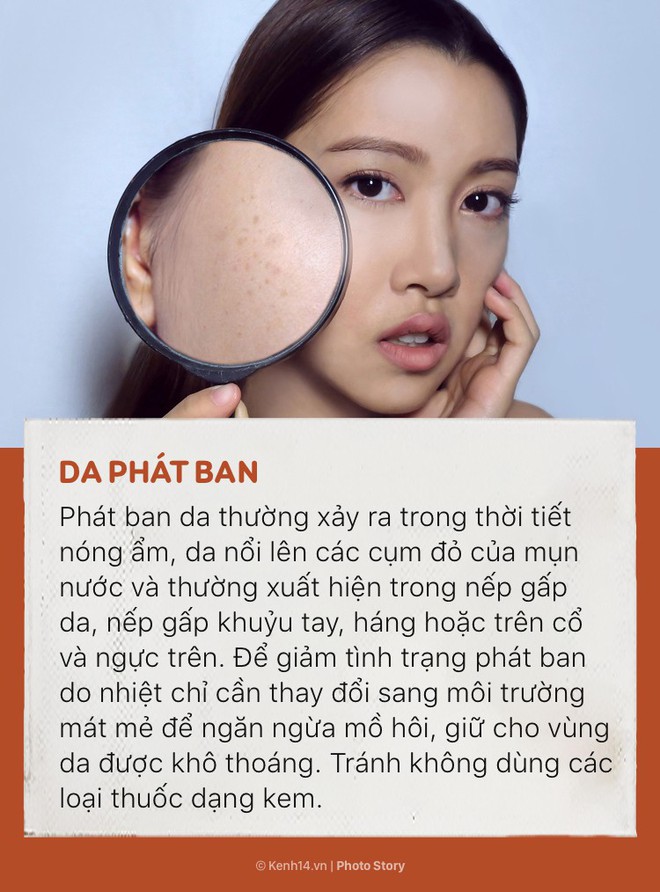 Những tác hại của ánh nắng mà bạn cần đề phòng cho những ngày hè đang tới - Ảnh 7.