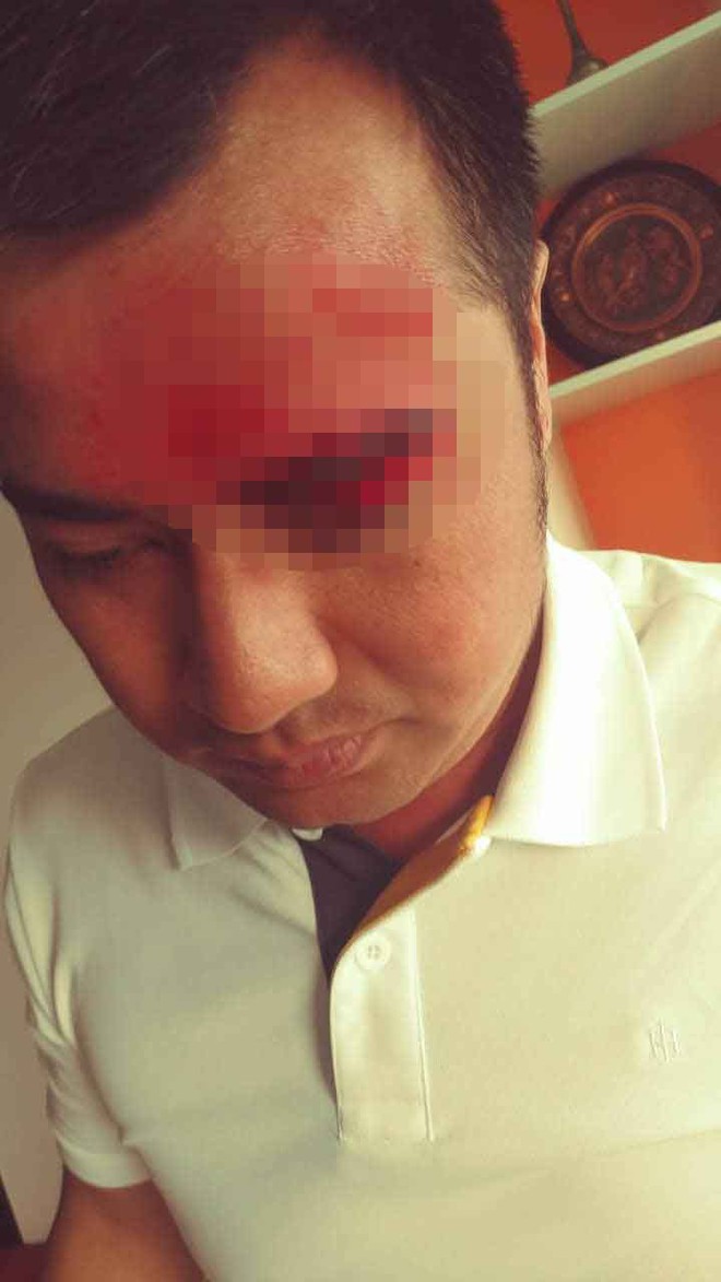 Phó giám đốc doanh nghiệp bị giang hồ đánh trọng thương ở Sài Gòn - Ảnh 1.