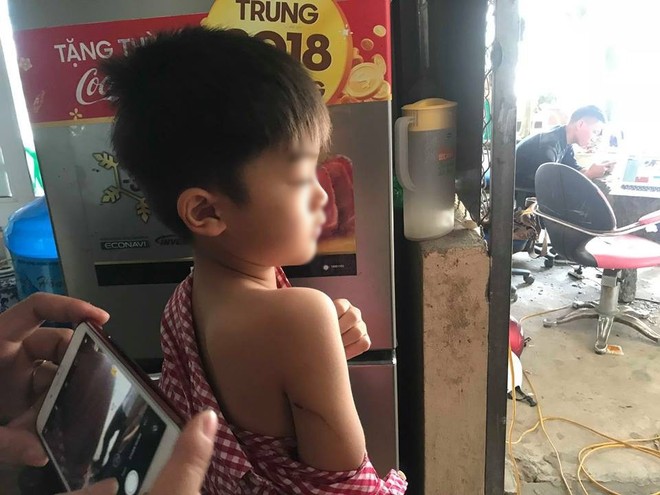 Vụ đ&agrave;n ch&oacute; cắn b&eacute; trai 7 tuổi tử vong: Lời kể h&atilde;i h&ugrave;ng của 1 em b&eacute; từng may mắn tho&aacute;t chết - Ảnh 3.