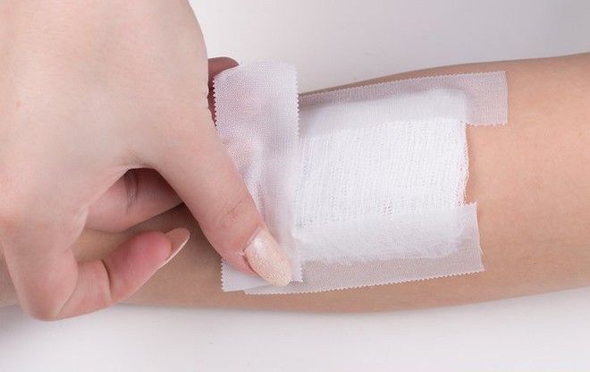 L&agrave;m g&igrave; khi bị ch&oacute; cắn: những việc ai cũng cần biết để tr&aacute;nh hậu quả nghi&ecirc;m trọng - Ảnh 2.