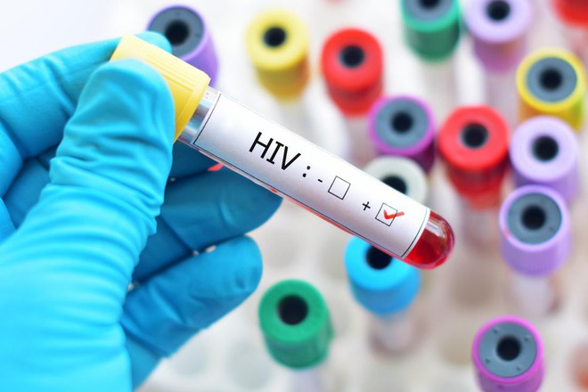 Bị kim tiêm, vật nhọn đâm, nghi ngờ nhiễm HIV thì cần làm những gì để phòng tránh nguy hiểm? - Ảnh 1.