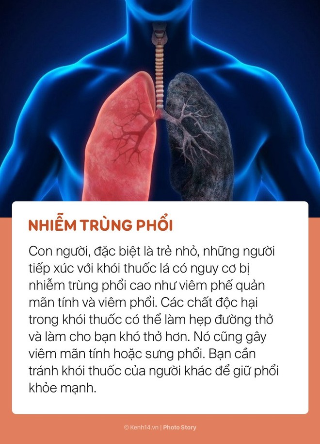 Khói thuốc lá và những tác hại nghiêm trọng đến sức khoẻ của những người xung quanh - Ảnh 1.