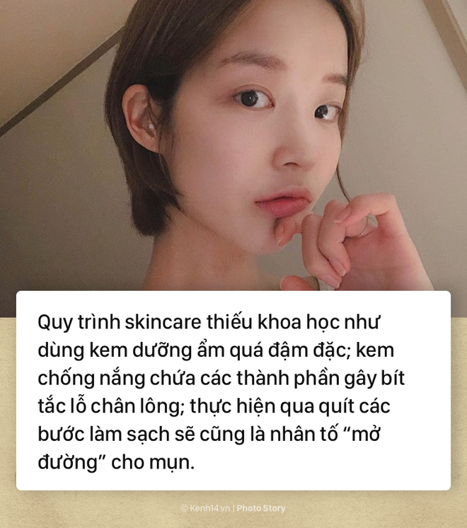 Để khắc phục tình trạng mụn biểu tình vào mùa hè các nàng cần chú ý ngay tips skincare sau - Ảnh 3.