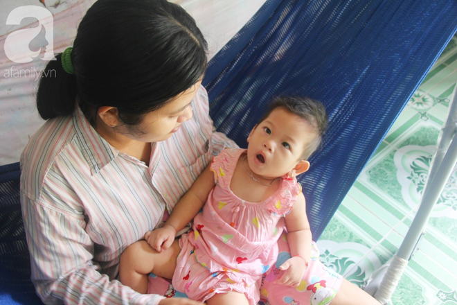 B&eacute; g&aacute;i 1 tuổi co giật li&ecirc;n tục đến mức m&eacute;o miệng, người mẹ trẻ kh&oacute;c cạn nước mắt cầu xin một cơ hội sống cho con - Ảnh 18.