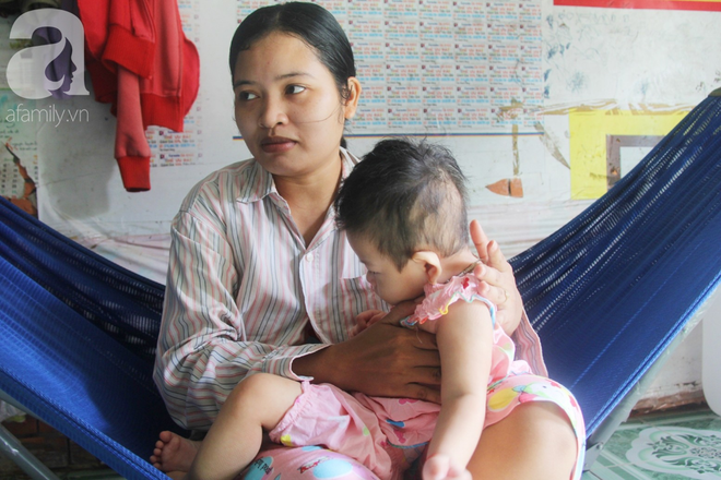 B&eacute; g&aacute;i 1 tuổi co giật li&ecirc;n tục đến mức m&eacute;o miệng, người mẹ trẻ kh&oacute;c cạn nước mắt cầu xin một cơ hội sống cho con - Ảnh 9.