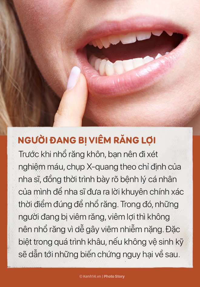Không nhổ răng khôn vào những thời điểm sau để tránh các biến chứng ảnh hưởng tới sức khoẻ - Ảnh 1.