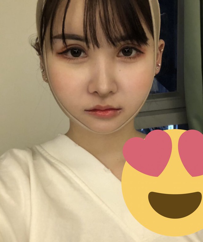 Chỉ v&igrave; một c&acirc;u n&oacute;i của bố, c&ocirc; g&aacute;i n&agrave;y đ&atilde; quyết định chi 3,1 tỉ để phẫu thuật thẩm mỹ - Ảnh 4.