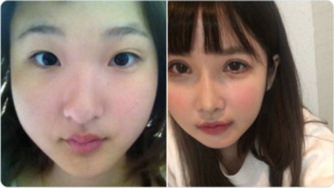 Chỉ v&igrave; một c&acirc;u n&oacute;i của bố, c&ocirc; g&aacute;i n&agrave;y đ&atilde; quyết định chi 3,1 tỉ để phẫu thuật thẩm mỹ - Ảnh 5.