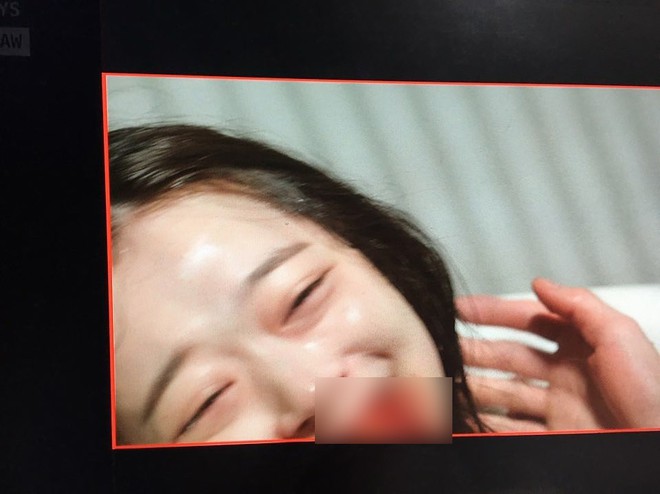 Đăng ảnh vừa cười vừa hộc m&aacute;u mồm l&ecirc;n Instagram, chuyện g&igrave; đang xảy ra với Sulli vậy? - Ảnh 1.