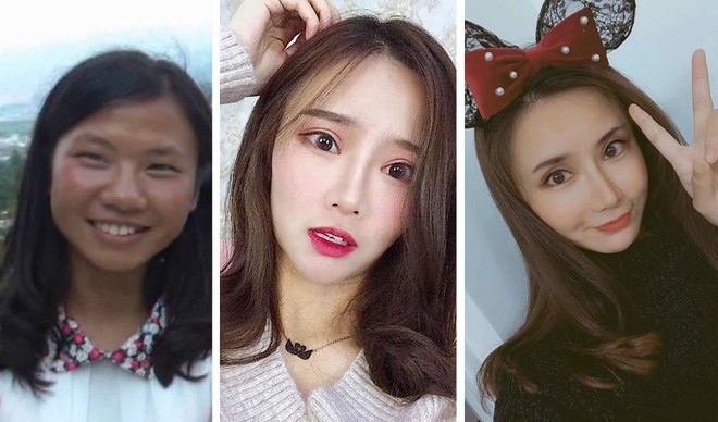 Những c&ocirc; g&aacute;i đập mặt x&acirc;y lại ở Trung Quốc: Đời sang trang nhờ diện mạo mới đến nỗi xem b&aacute;c sĩ thẩm mỹ l&agrave; cha mẹ thứ 2 - Ảnh 1.