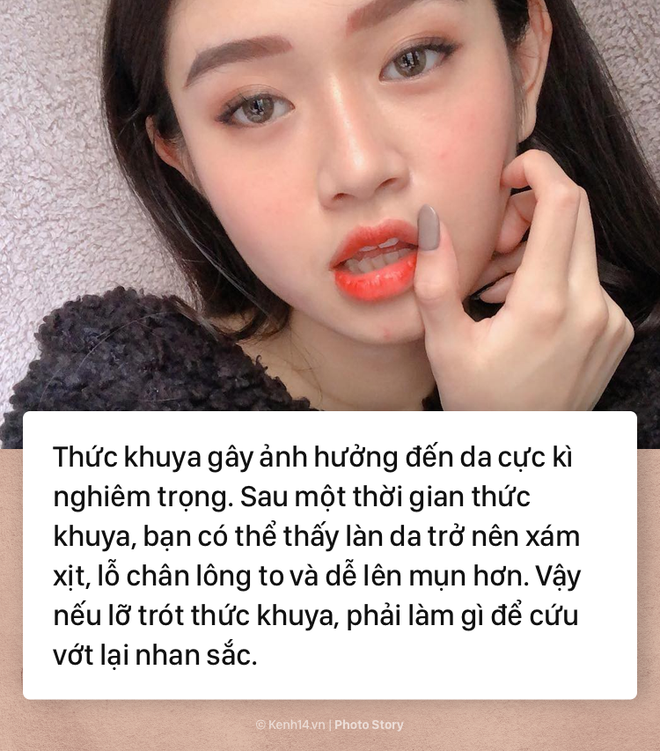 Thực hiện ngay những điều này để cứu vớt nhan sắc xuống cấp vì thức khuya - Ảnh 1.