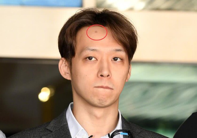 Yoochun d&ugrave;ng ma tu&yacute; xong đập đầu v&agrave;o tường, dấu vết c&ograve;n y nguy&ecirc;n tr&ecirc;n tr&aacute;n trong ng&agrave;y bị c&ograve;ng tay? - Ảnh 2.
