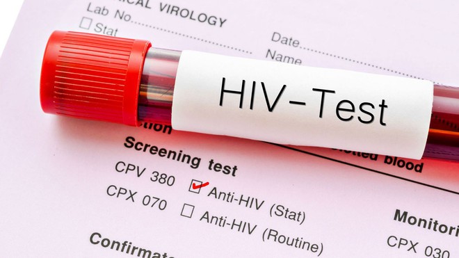 Bị kim tiêm, vật nhọn đâm: để chống phơi nhiễm HIV bạn nhất thiết phải lưu ý những điều sau - Ảnh 3.