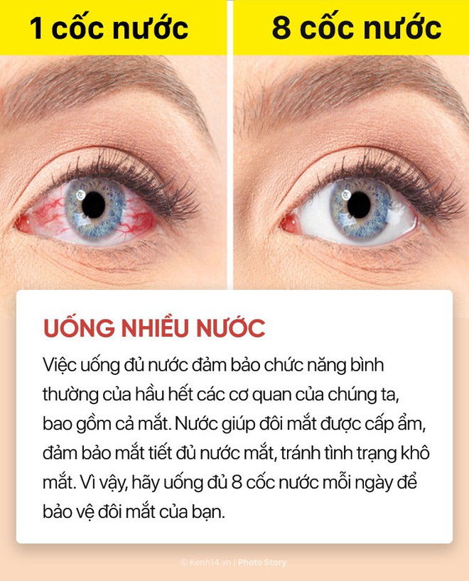 Tạm biệt nỗi lo kh&ocirc; mắt, nhức mắt chỉ bằng những c&aacute;ch đơn giản sau - Ảnh 11.