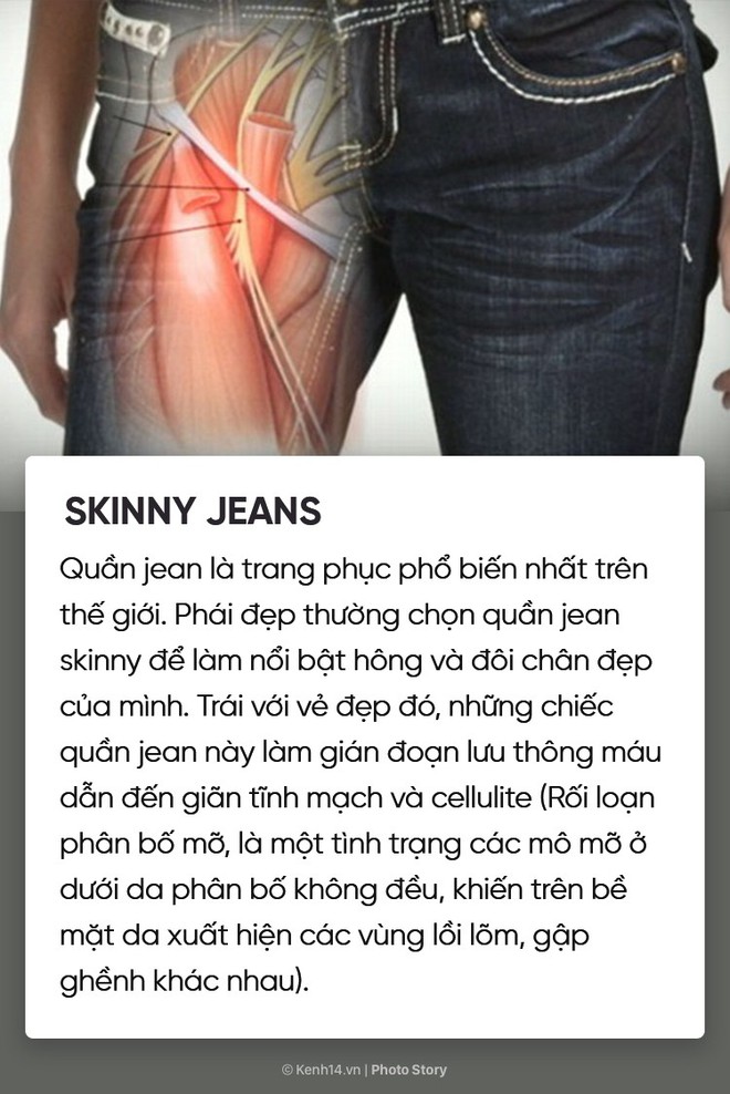 Sức khoẻ của bạn c&oacute; thể bị ảnh hưởng mỗi ng&agrave;y bởi 7 m&oacute;n đồ thời trang quen thuộc - Ảnh 1.