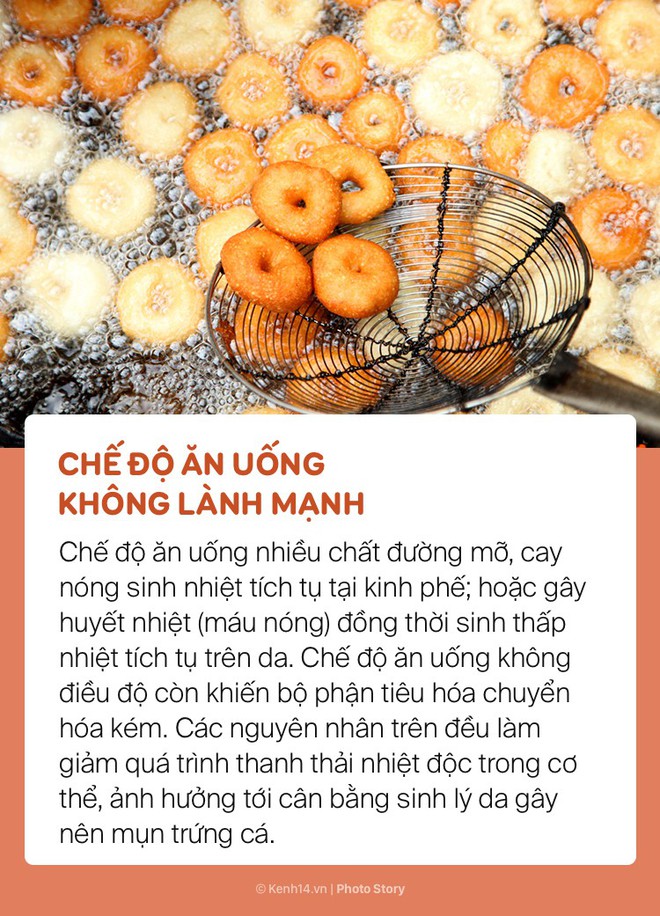 Mụn mọc đầy lưng thì hãy chú ý xem bạn có mắc những sai lầm này  - Ảnh 11.