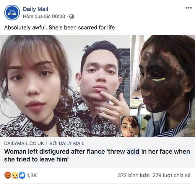 Dân mạng nước ngoài bày tỏ sự thương cảm với cô gái Việt Nam bị chồng sắp cưới tạt axit đến biến dạng khuôn mặt - Ảnh 3.