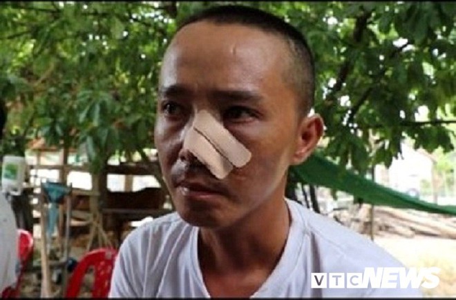 Ba cha con bị 20 người truy s&aacute;t: Nạn nh&acirc;n phẫn uất kể 3 trận đ&aacute;nh trong một buổi chiều - Ảnh 1.