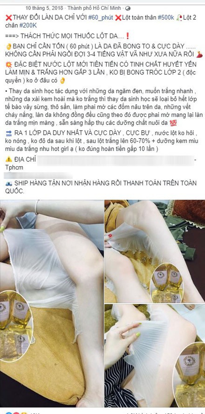 Lột da sinh học: Phương ph&#225;p l&#224;m trắng cấp tốc được quảng c&#225;o thần kỳ nhưng ẩn sau l&#224; đầy rẫy nguy hại - Ảnh 1.