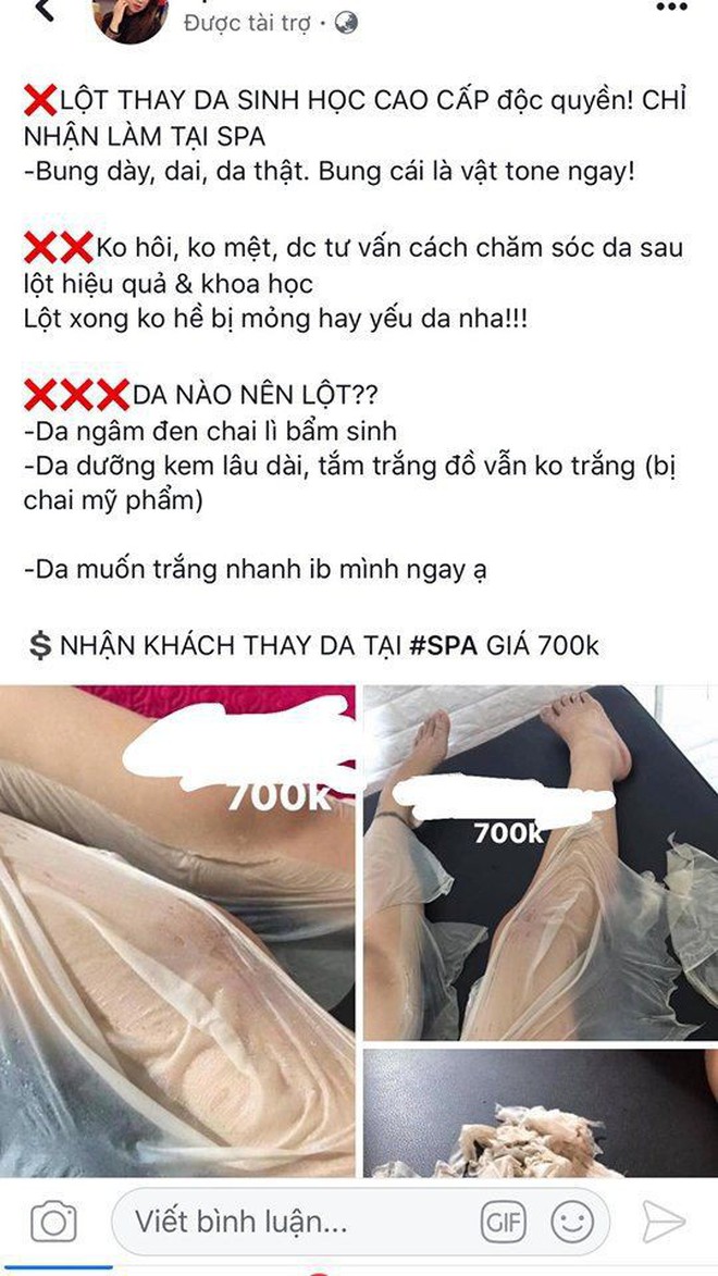 Lột da sinh học: Phương ph&#225;p l&#224;m trắng cấp tốc được quảng c&#225;o thần kỳ nhưng ẩn sau l&#224; đầy rẫy nguy hại - Ảnh 1.