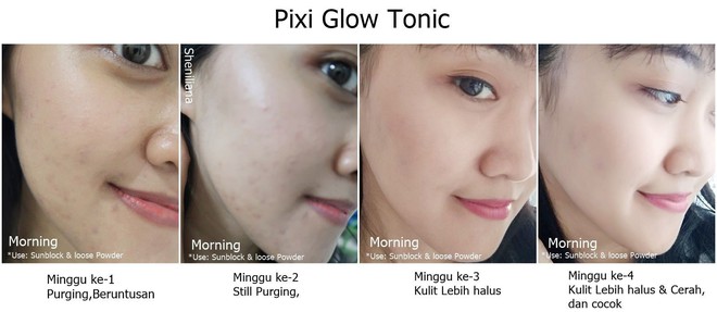 Không có tiền mua chai toner xịn sò giá 2,6 triệu, bạn có thể tìm đến 6 phiên bản bình dân rẻ hều này  - Ảnh 4.