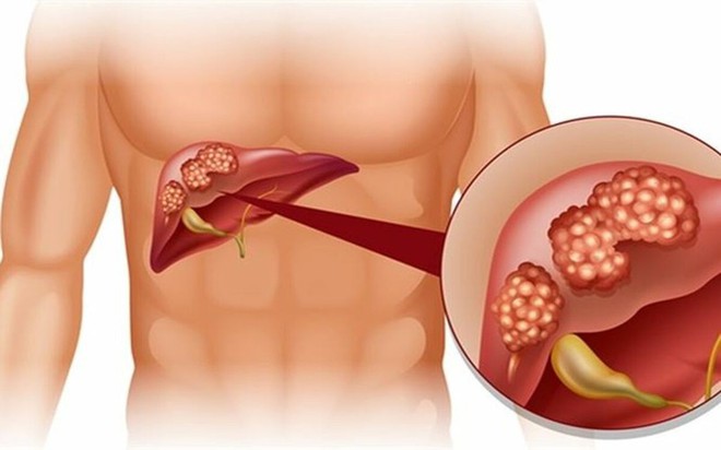 12 lý do nên “từ chối” thức ăn nhanh - Ảnh 5.