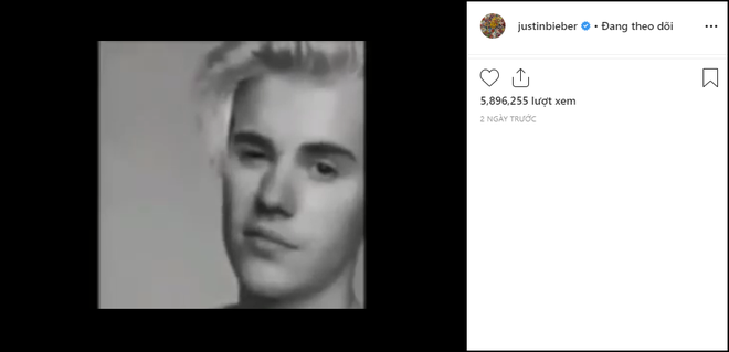 Justin Bieber vừa khóa cả đống comment Instagram: Là do có biến hay không biết dùng hết chức năng? - Ảnh 1.