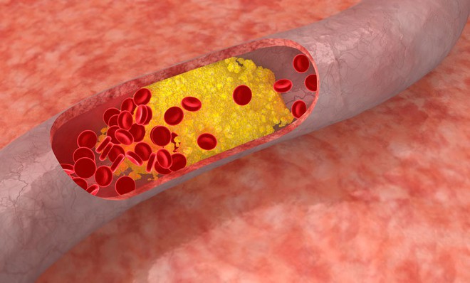 Nghiên cứu chứng minh: dầu cá chính là loại thực phẩm giúp kiểm soát cholesterol vô cùng hiệu quả - Ảnh 1.