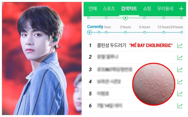 Loại bệnh leo lên top 1 tìm kiếm Naver mà V (BTS) đang mắc phải gây nguy hiểm tới mức nào? - Ảnh 4.