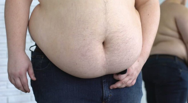 Giảm giá 67% cho các anh trai có bụng ông Địa, công viên nước Đài Loan gây tranh cãi lớn vì cổ súy đàn ông béo phì - Ảnh 2.