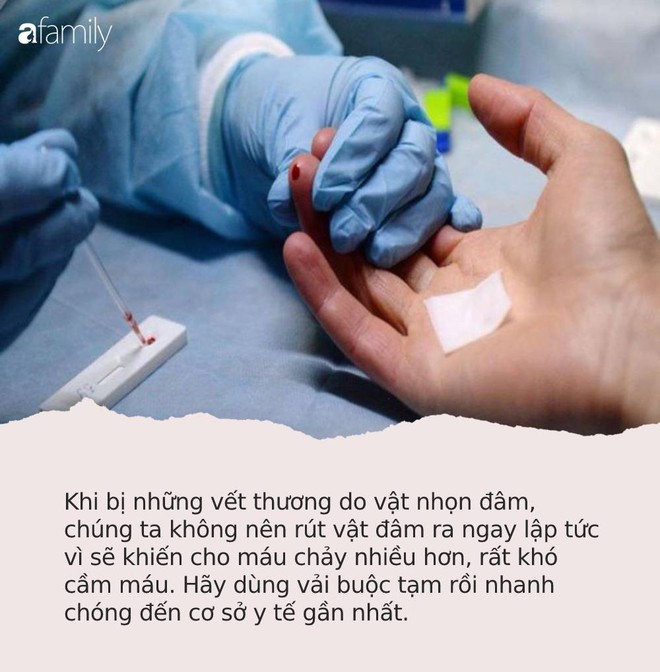 Người phụ nữ gặp nạn vì bị cá “dính chặt” vào tay, vào viện cấp cứu bác sĩ lại khen hết lời vì đã làm tốt việc này - Ảnh 3.