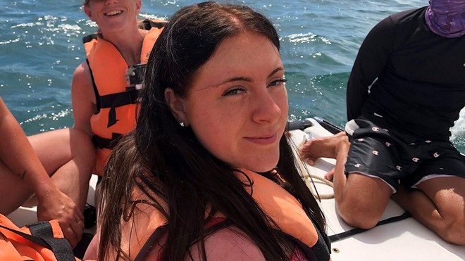 Cô gái 16 tuổi bị bỏng nắng nghiêm trọng khiến vùng lưng nổi đầy mụn nước siêu to khổng lồ - Ảnh 1.