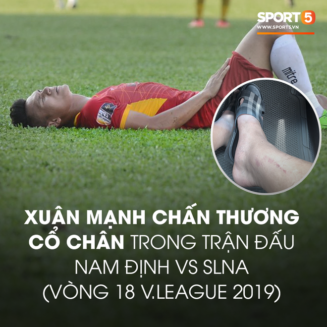 Hãi hùng với chấn thương của các cầu thủ thi đấu V.League: Ai nói bóng đá Việt nhàm chán và thiếu lửa? - Ảnh 2.