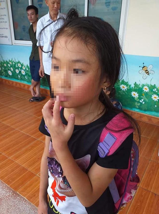 Khẩn trương xác minh thông tin cô giáo bạo hành học sinh ở Quảng Ninh - Ảnh 1.