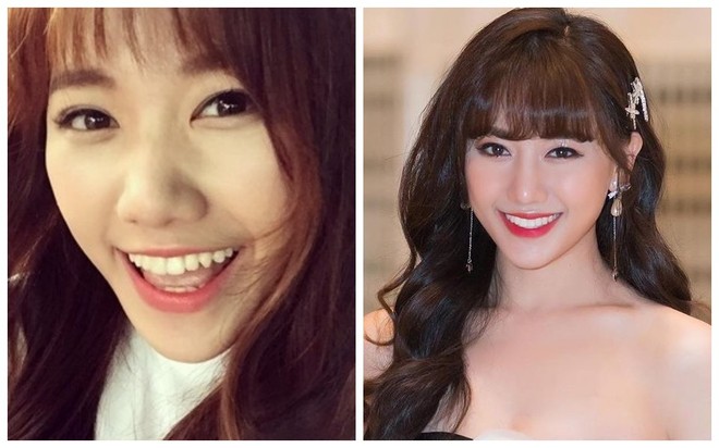 Đâu chỉ có ở Hàn, showbiz Việt cũng có cả loạt sao lột xác, khoe nụ cười đắt giá nhờ thẩm mỹ răng - Ảnh 4.