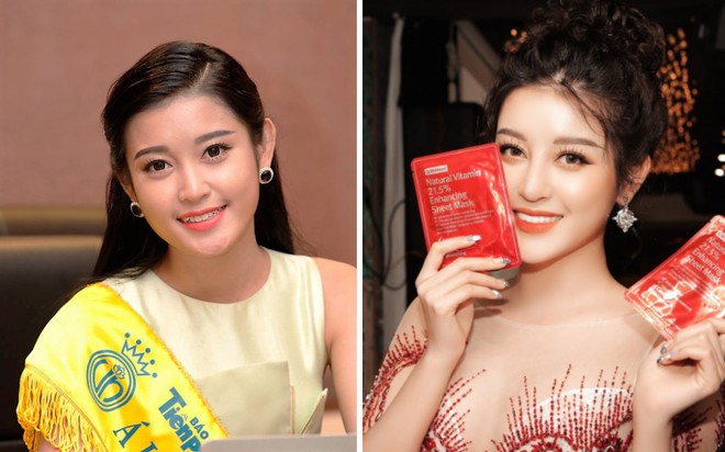 Đâu chỉ có ở Hàn, showbiz Việt cũng có cả loạt sao lột xác, khoe nụ cười đắt giá nhờ thẩm mỹ răng - Ảnh 9.