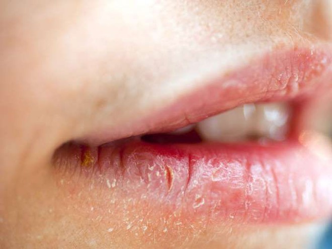 Cơ thể đang thiếu hụt một v&agrave;i chất quan trọng nếu bạn gặp phải h&agrave;ng loạt dấu hiệu bất thường sau - Ảnh 3.