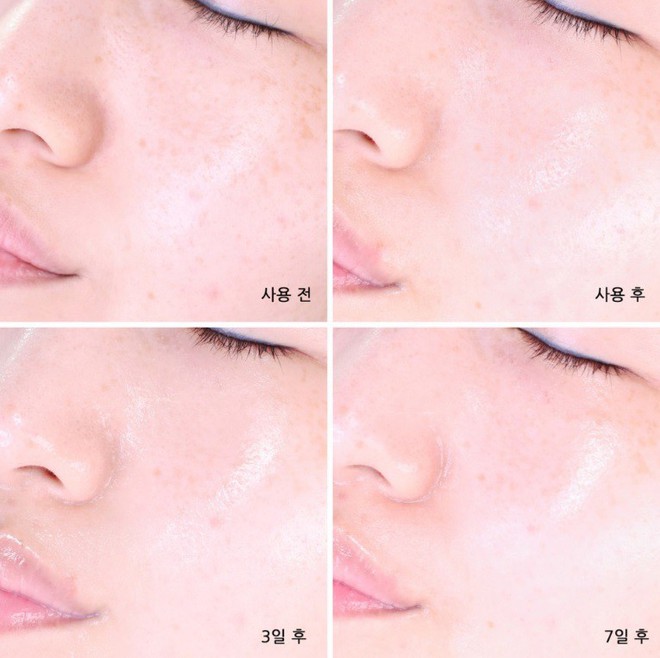 Serum nhầy ốc s&ecirc;n l&agrave;m đầy sẹo rỗ hot rần rần, bạn sẽ biết n&ecirc;n mua hay kh&ocirc;ng khi xem loạt review người thật việc thật n&agrave;y - Ảnh 6.
