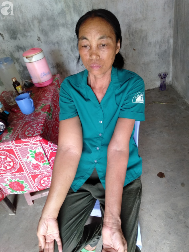 Lời khẩn cầu của người mẹ ung thư mong chữa bệnh cho con trai suy thận: Nếu phải chết, t&ocirc;i xin được chết thay con - Ảnh 4.