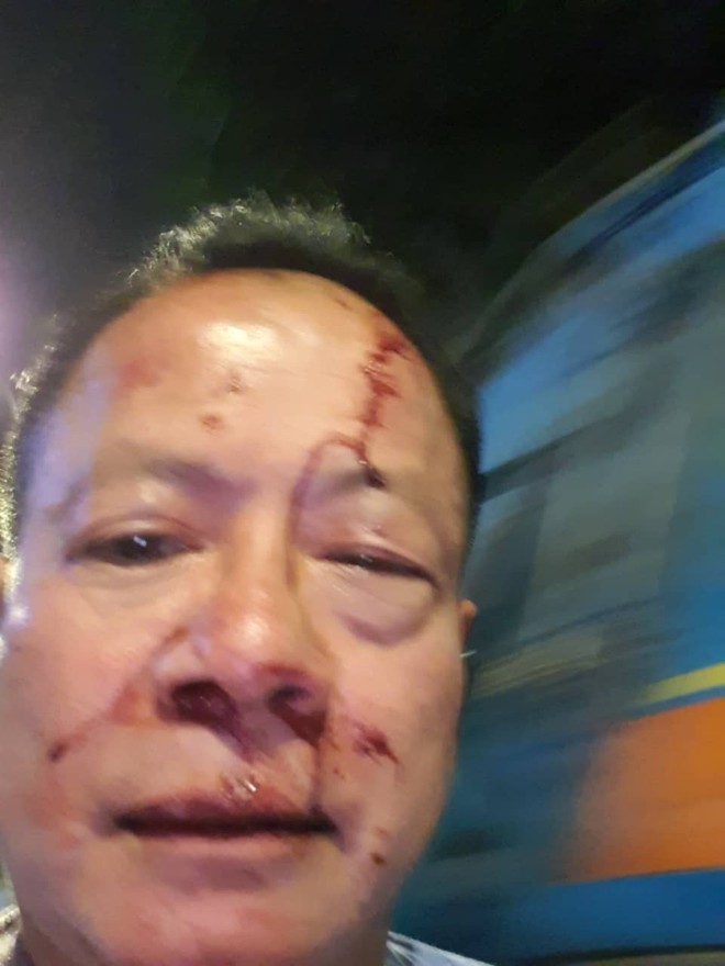 Nhóm thanh niên đánh Việt Kiều Đức trọng thương trong quán karaoke ở Sài Gòn - Ảnh 1.