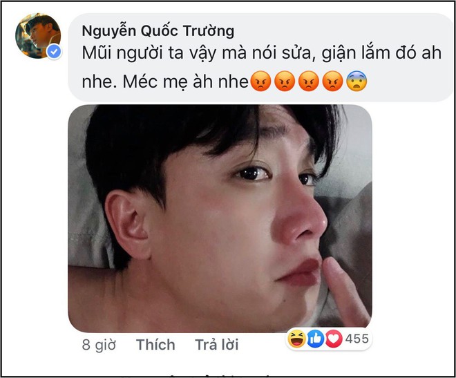 Nổi tiếng thân thiện nhưng cũng có ngày Quốc Trường gay gắt đáp trả chỉ vì bị nghi sửa mũi - Ảnh 3.