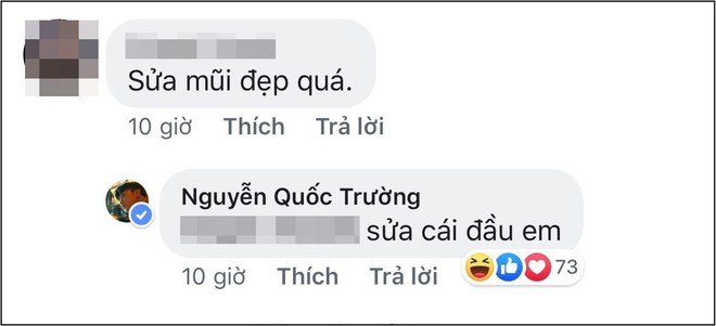 Nổi tiếng thân thiện nhưng cũng có ngày Quốc Trường gay gắt đáp trả chỉ vì bị nghi sửa mũi - Ảnh 2.