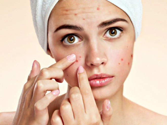 L&agrave;n da khỏe v&agrave; sạch mụn dễ như ăn kẹo nhờ 5 tips cơ bản m&agrave; ai cũng c&oacute; thể l&agrave;m theo - Ảnh 2.