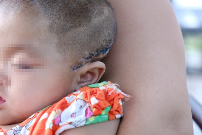 Mẹ của b&eacute; g&aacute;i 8 th&aacute;ng tuổi nghi bị xuất huyết n&atilde;o ngay ng&agrave;y đầu ti&ecirc;n gửi nh&agrave; trẻ: C&ocirc; gi&aacute;o n&oacute;i b&eacute; tự bị c&ograve;n camera th&igrave; hỏng? - Ảnh 8.