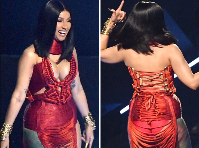 Không dám nhìn hình ảnh Cardi B quyết hở bạo, lồ lộ đôi chân biến dạng nặng nề hậu dao kéo tại VMAs - Ảnh 1.