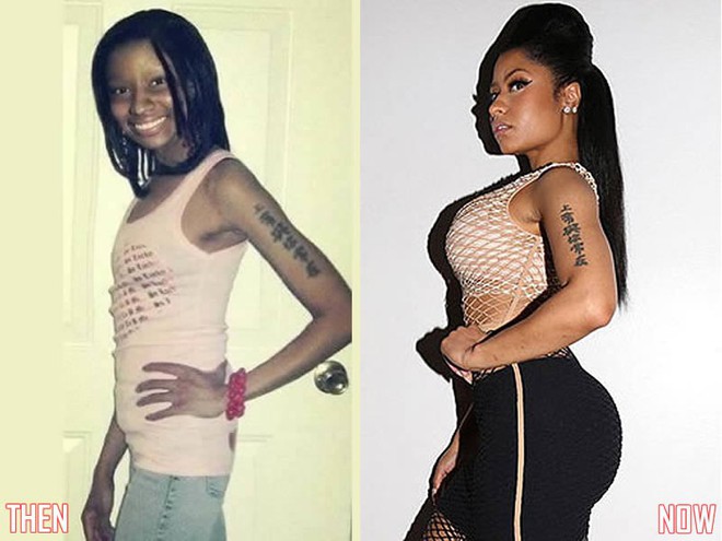 Korean social media is in an uproar because Nicki Minaj's past photos were revealed to be flat, a world apart from her current voluptuous body - Photo 2.