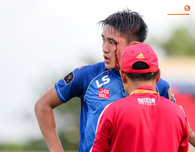 Máu đổ ròng ròng trên mặt trung vệ U22 Việt Nam trong trận đấu ở vòng 23 V.League 2019 - Ảnh 1.